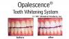 teeth whitening gelเหมาะสำหรับคนที่มีเวลาจำกัดเดินทางบ่อย ฟันขาวปิ๊งแบบดาราได้ใน 3วันไม่ต้องใช้เครื่องฉายแสงเคล็ดลับฟันขาวของดารา